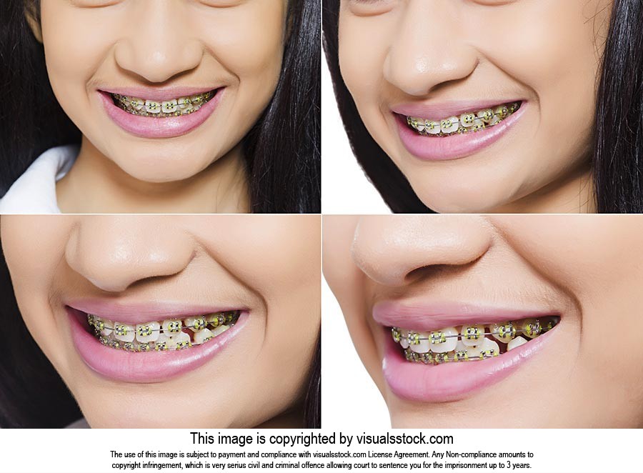 Montage Photo Girl Teeth