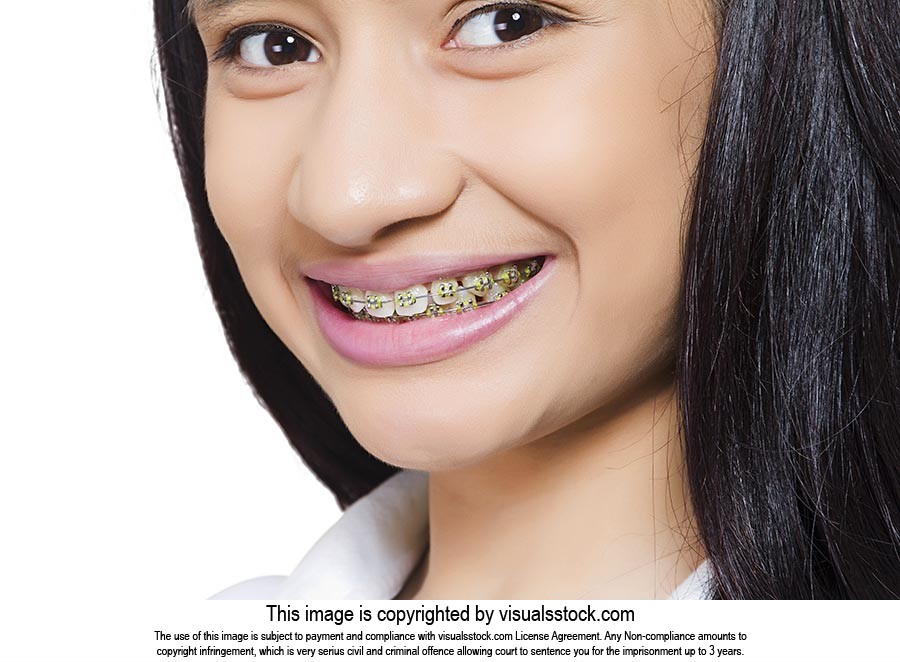 Teenage Girl Braces Teeth