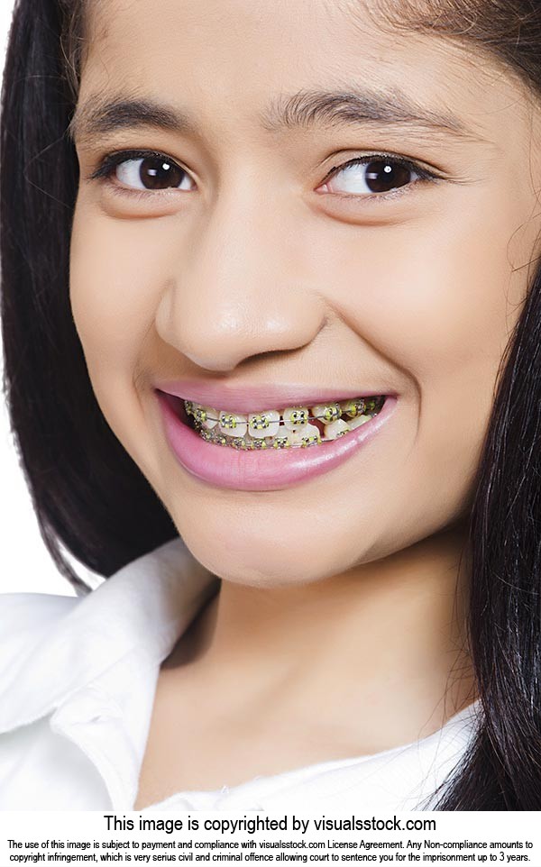 Indian Teenager Girl Braces Teeth