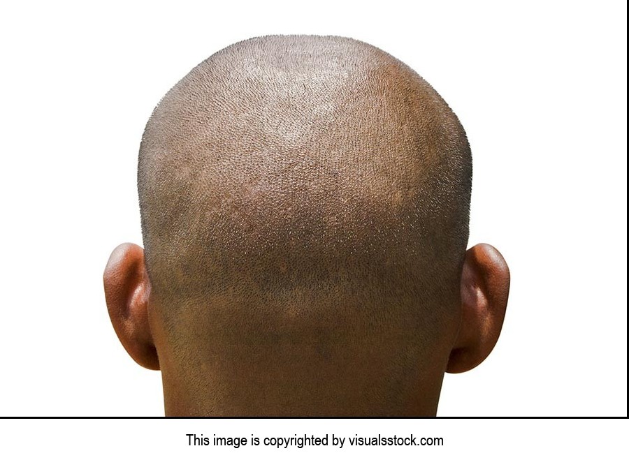 1 Person Only ; 25-30 Years ; Adult Man ; Balding 