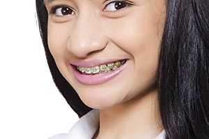 Teenage Girl Braces Teeth