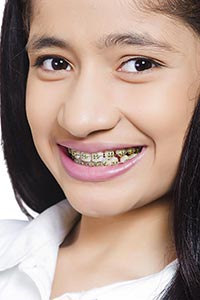 Indian Teenager Girl Braces Teeth